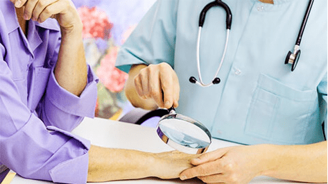 Diagnoza i leczenie brodawczaków